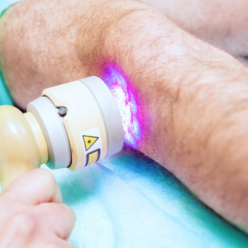 Laser therapy for the treatment of lymphedema and diabetic foot ulcers